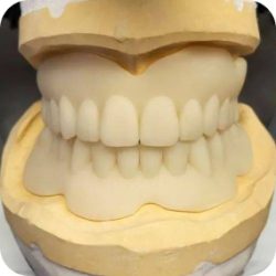 Model of dentures.
