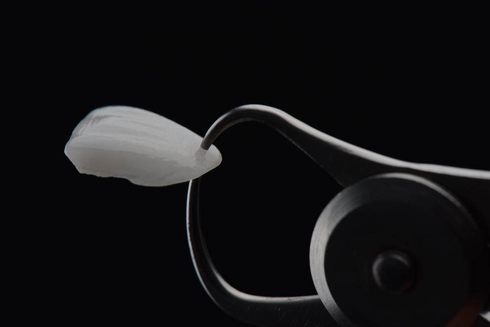 Porcelain Veneers in dental tool