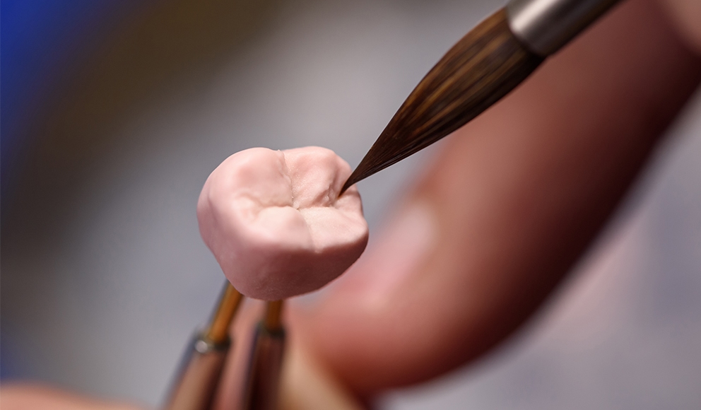 Image of dental crown